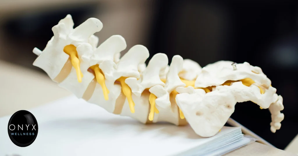 Anatomical model of the human spine showing vertebrae and intervertebral discs