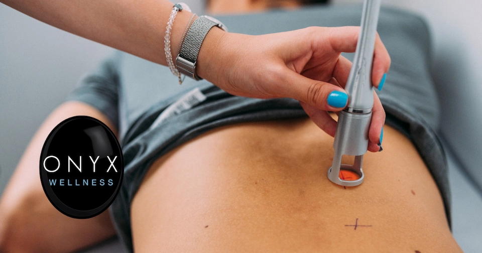 chiropractic patient receiving high power laser therapy on the back